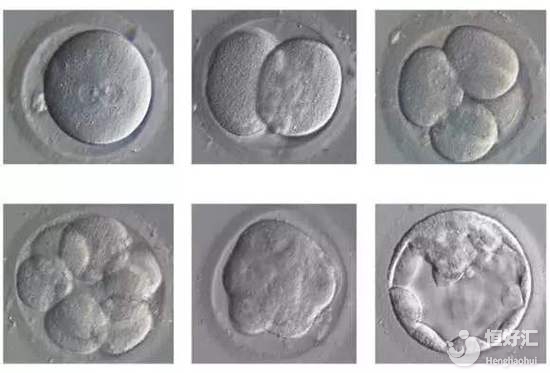 輔助生殖中的養(yǎng)囊是什么？會使高齡試管成功率變高嗎？